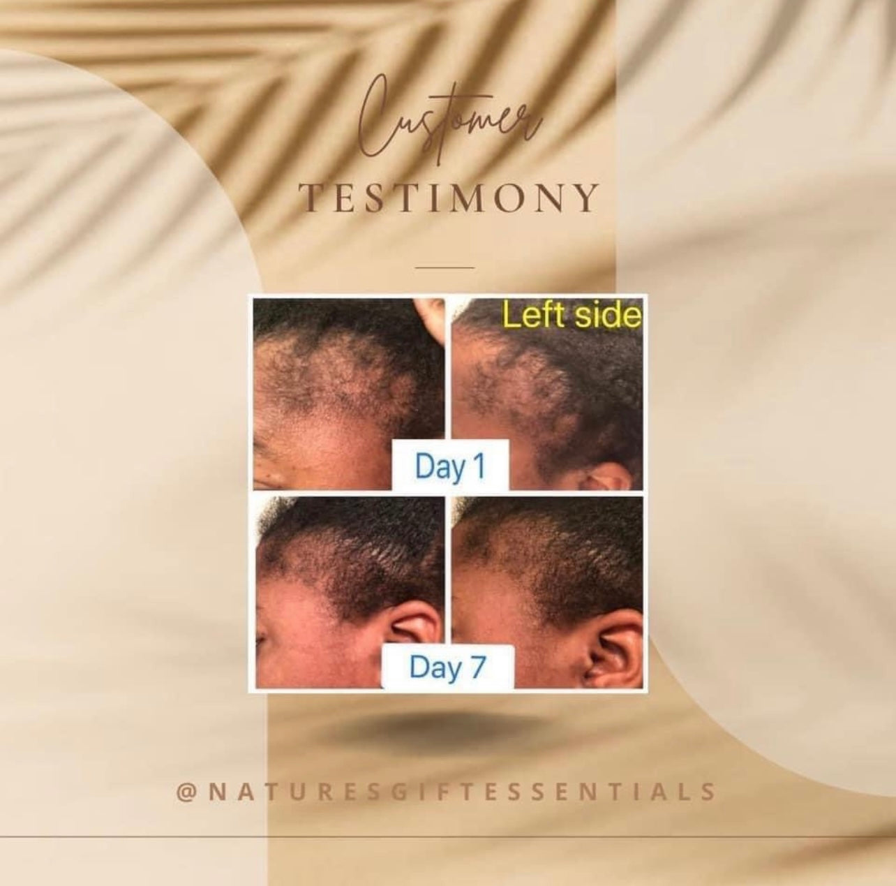 Hair Growth Serum