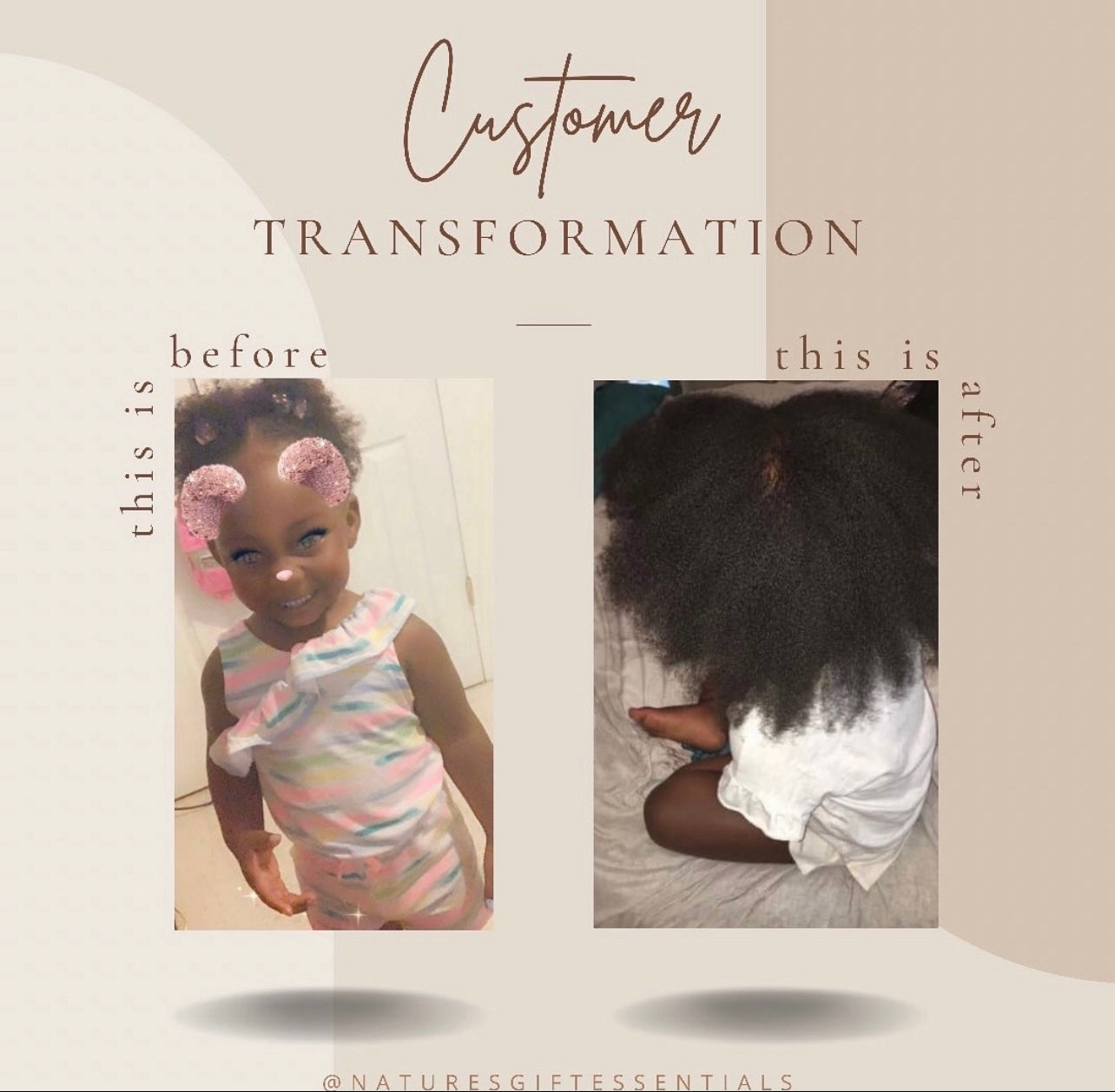 Hair Growth Serum