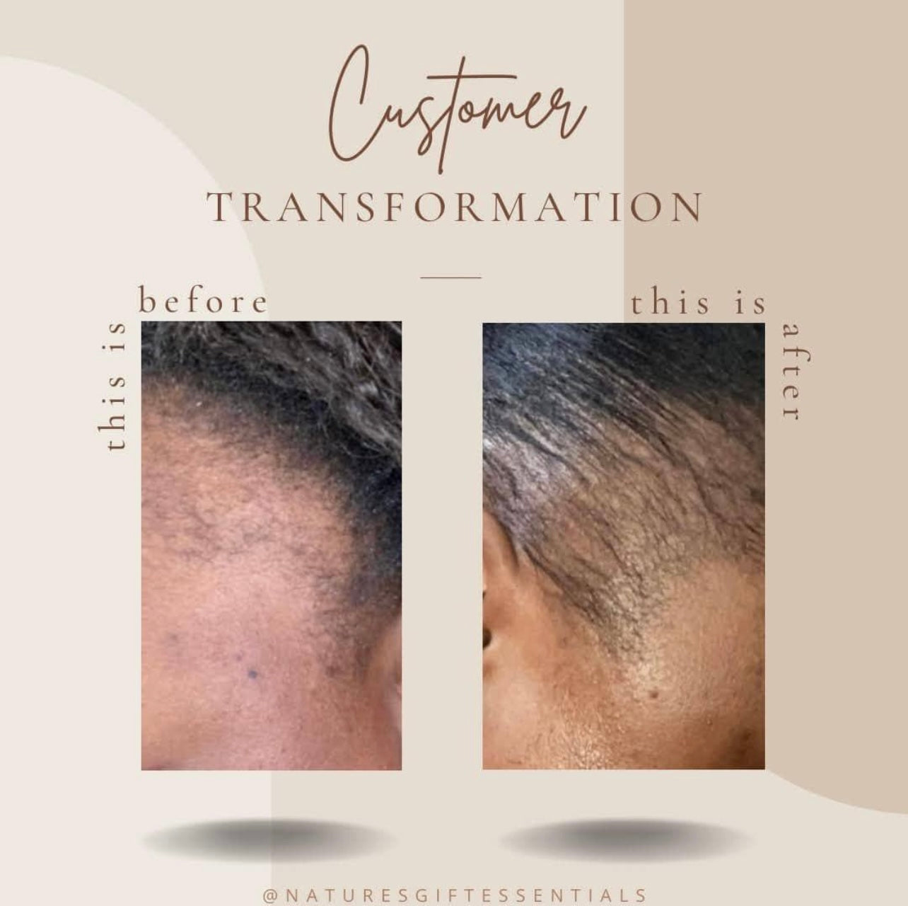Hair Growth Serum