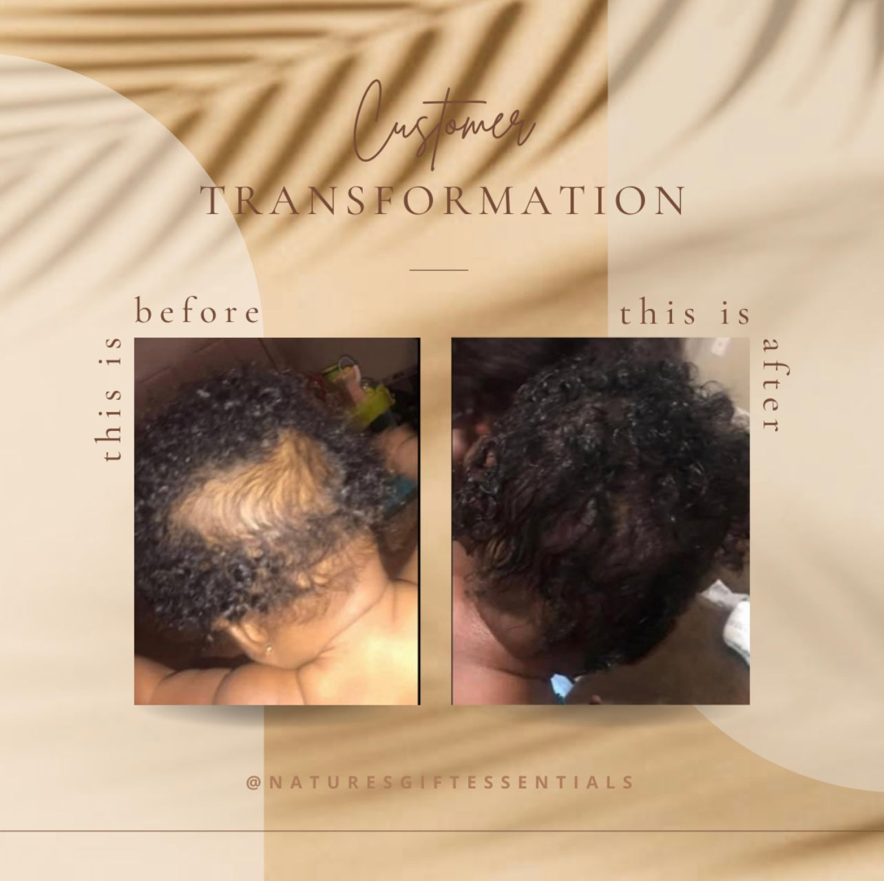 Hair Growth Serum